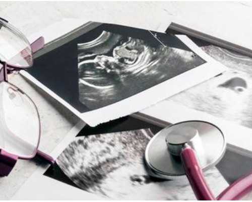 孕酮正常值是多少？孕酮偏低有哪些影響