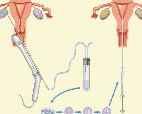 成都試管嬰兒技術靠譜嗎?成功率高不高